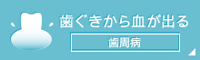 歯ぐきから血が出る歯周病