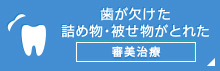 歯が欠けた詰め物・被せ物がとれた審美治療